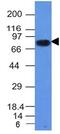 CD86 antibody, GTX34569, GeneTex, Western Blot image 