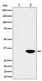 Nucleophosmin 1 antibody, P00450, Boster Biological Technology, Western Blot image 