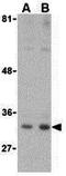 C1q And TNF Related 1 antibody, GTX85080, GeneTex, Western Blot image 