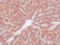 Interleukin 1 Receptor Associated Kinase 1 antibody, PM-5315, ProSci, Immunohistochemistry paraffin image 