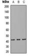 RAB8B, Member RAS Oncogene Family antibody, orb376169, Biorbyt, Western Blot image 