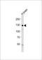 Amphiphysin antibody, M02364, Boster Biological Technology, Western Blot image 