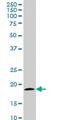 Translocase Of Outer Mitochondrial Membrane 22 antibody, ab57523, Abcam, Western Blot image 