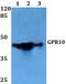 Prolactin-releasing peptide receptor antibody, PA5-75372, Invitrogen Antibodies, Western Blot image 