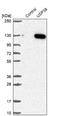 Ubiquitin Specific Peptidase 38 antibody, NBP2-13510, Novus Biologicals, Western Blot image 