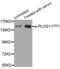 Phospholipase C Gamma 1 antibody, LS-C335937, Lifespan Biosciences, Western Blot image 