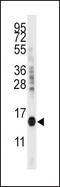 Cytidine Deaminase antibody, PA5-12497, Invitrogen Antibodies, Western Blot image 