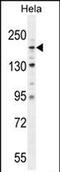 Collagen Type IV Alpha 2 Chain antibody, PA5-71538, Invitrogen Antibodies, Western Blot image 