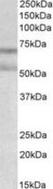 Cannabinoid Receptor 1 antibody, MBS422809, MyBioSource, Western Blot image 