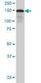 Scaffold Attachment Factor B antibody, H00006294-M04, Novus Biologicals, Western Blot image 