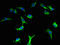 LPS Responsive Beige-Like Anchor Protein antibody, LS-C285555, Lifespan Biosciences, Immunofluorescence image 