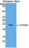 Interleukin-17B antibody, LS-C314880, Lifespan Biosciences, Western Blot image 