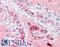 Checkpoint Kinase 2 antibody, LS-B7598, Lifespan Biosciences, Immunohistochemistry frozen image 