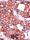 Cell Division Cycle 25A antibody, A01433-2, Boster Biological Technology, Immunohistochemistry paraffin image 