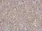 Interleukin 1 Receptor Associated Kinase 4 antibody, LS-C155351, Lifespan Biosciences, Immunohistochemistry paraffin image 