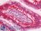 Galectin 3 antibody, LS-B11571, Lifespan Biosciences, Immunohistochemistry paraffin image 