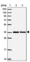 Basic, Immunoglobulin-Like Variable Motif Containing antibody, PA5-62140, Invitrogen Antibodies, Western Blot image 