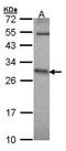 Hypoxanthine Phosphoribosyltransferase 1 antibody, TA308901, Origene, Western Blot image 