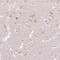 ABR Activator Of RhoGEF And GTPase antibody, NBP2-49152, Novus Biologicals, Immunohistochemistry frozen image 