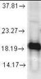 Superoxide Dismutase 1 antibody, orb95891, Biorbyt, Western Blot image 