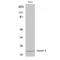Claudin 4 antibody, LS-B14814, Lifespan Biosciences, Western Blot image 