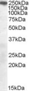 Sortilin Related Receptor 1 antibody, orb18882, Biorbyt, Western Blot image 