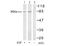 Component Of Inhibitor Of Nuclear Factor Kappa B Kinase Complex antibody, AP02652PU-S, Origene, Western Blot image 