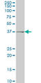 Alcohol Dehydrogenase 6 (Class V) antibody, LS-C196619, Lifespan Biosciences, Western Blot image 