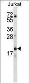 Keratin Associated Protein 13-3 antibody, PA5-71700, Invitrogen Antibodies, Western Blot image 