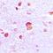 Mothers against decapentaplegic homolog 9 antibody, LS-C668192, Lifespan Biosciences, Immunohistochemistry paraffin image 