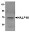 NLR Family Pyrin Domain Containing 10 antibody, LS-B5332, Lifespan Biosciences, Western Blot image 