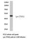 LYN Proto-Oncogene, Src Family Tyrosine Kinase antibody, LS-C176288, Lifespan Biosciences, Western Blot image 