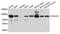 Mitogen-Activated Protein Kinase Binding Protein 1 antibody, A10423, Boster Biological Technology, Immunohistochemistry paraffin image 