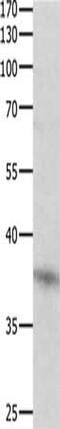 Dual Specificity Phosphatase 12 antibody, CSB-PA229389, Cusabio, Western Blot image 