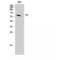 Tyrosine Hydroxylase antibody, LS-C386423, Lifespan Biosciences, Western Blot image 