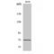 Protein Tyrosine Phosphatase Non-Receptor Type 11 antibody, LS-C381188, Lifespan Biosciences, Western Blot image 