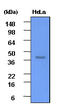 Casein Kinase 2 Alpha 1 antibody, MBS200041, MyBioSource, Western Blot image 