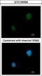 Protein Kinase CAMP-Dependent Type II Regulatory Subunit Beta antibody, GTX105558, GeneTex, Immunocytochemistry image 
