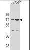 Zinc Finger Protein 324 antibody, LS-C160855, Lifespan Biosciences, Western Blot image 
