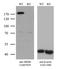 MutS Homolog 6 antibody, LS-C794202, Lifespan Biosciences, Western Blot image 