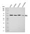 Fyn Related Src Family Tyrosine Kinase antibody, A04075-1, Boster Biological Technology, Western Blot image 