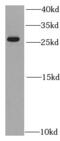 Proteasome Subunit Alpha 2 antibody, FNab06862, FineTest, Western Blot image 