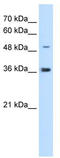 Iroquois-class homeodomain protein IRX-1 antibody, TA342477, Origene, Western Blot image 