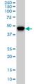 Phosphatidylinositol-5-Phosphate 4-Kinase Type 2 Alpha antibody, H00005305-M01, Novus Biologicals, Western Blot image 