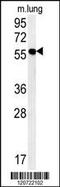 Zinc Finger MYND-Type Containing 10 antibody, MBS9215162, MyBioSource, Western Blot image 