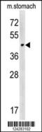 Carbohydrate Sulfotransferase 14 antibody, 57-375, ProSci, Western Blot image 