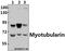 Myotubularin 1 antibody, A00749Y290, Boster Biological Technology, Western Blot image 