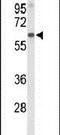 Afamin antibody, PA5-26455, Invitrogen Antibodies, Western Blot image 