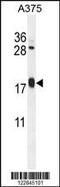 ADP Ribosylation Factor Like GTPase 8A antibody, MBS9215276, MyBioSource, Western Blot image 