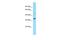 Uncharacterized protein C1orf183 antibody, A18165, Boster Biological Technology, Western Blot image 